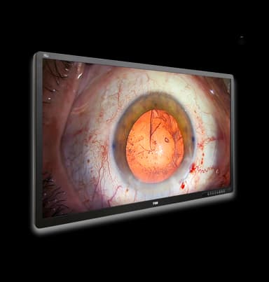 Медичний дисплей FSN FM-A5505DGC