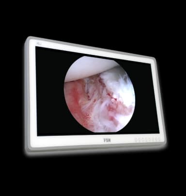 Медичний дисплей FSN FM-2701D_DG