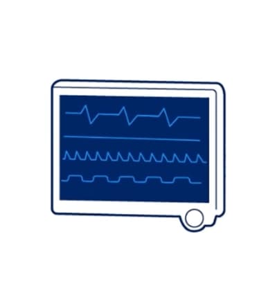 Моніторинг пацієнта